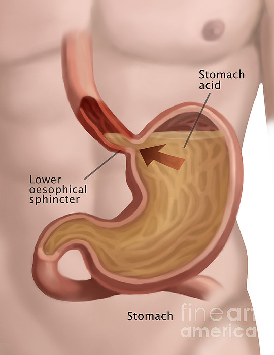 How to improve stomach acid levels?