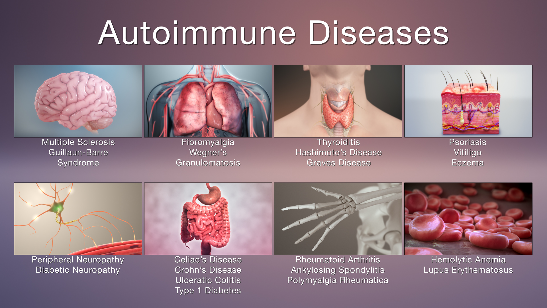 What are autoimmune diseases? How do you overcome them?