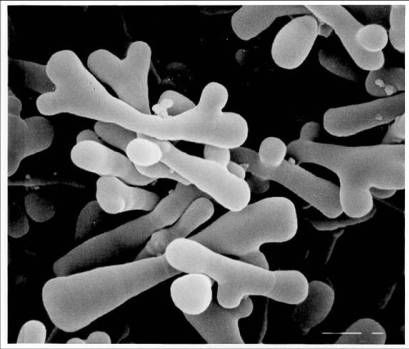 Bifidobacterium Longum: Impact on Gut Health