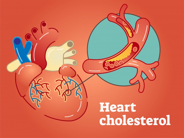 Is Cholesterol a relevant biomarker for Cardiovascular diseases?